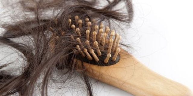 Ispadanje kose - kako spriječiti?